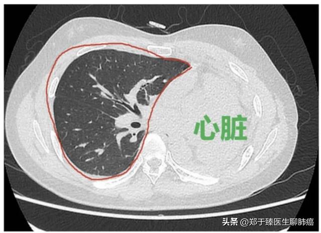 肺部手术后多久才能康复？康复的标准是什么？