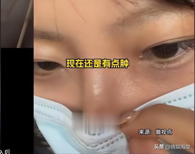 劝阻插队被老太打后续：女孩鼻梁受伤，警方介入后老人竟下跪卖惨