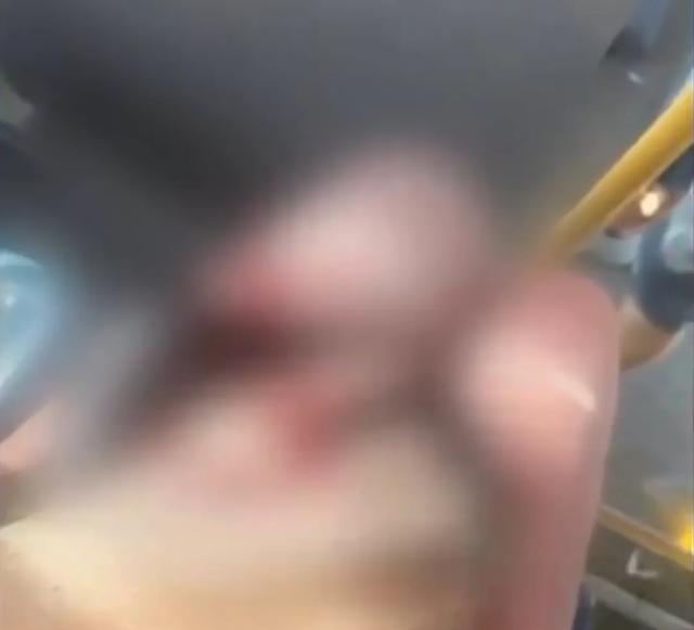 湖南长沙一女子乘坐公交时怀疑被老人性骚扰，理论后被老人用玻璃瓶砸伤流血，警方已介入