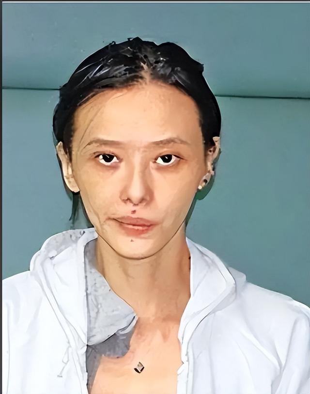 长得漂亮却坏事做尽，3次入狱	，被摘除4处器官的她，如今过得怎样