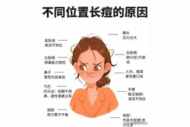 “身体不同部位长痘的原因”图片