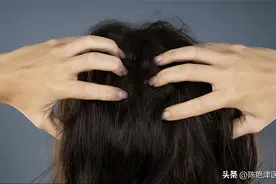 头皮里，老是长疙瘩和脓包，是怎么了？提醒：或是3种疾病警报图片