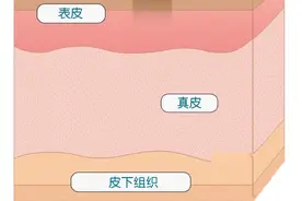 被蚊子叮了为什么会留下黑印？这些方法能去除→图片