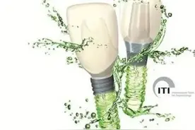 2023集采使用率最高的十大种植体品牌和价格，种牙必看图片