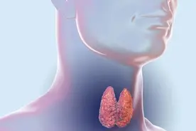 狐大医|得了甲状腺癌能活多久？图片