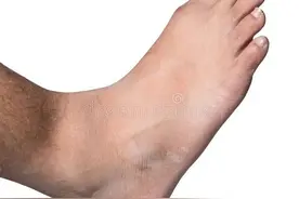 脚背使劲上抬感觉一根筋疼图片