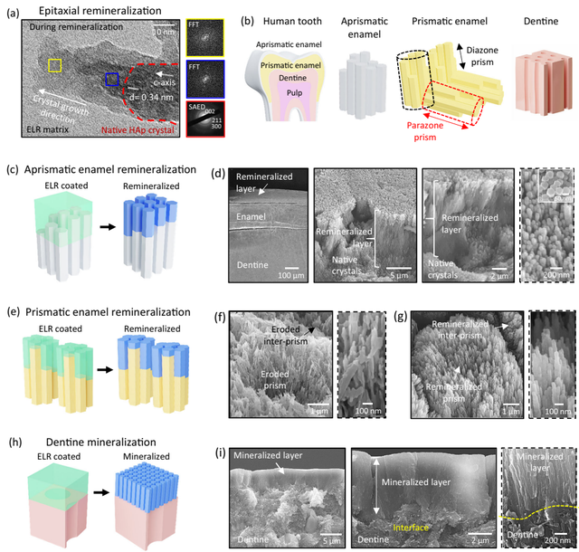 革命性牙釉质再生技术：从实验室到临床的突破