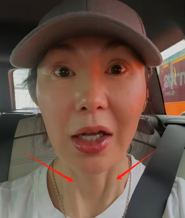 苹果肌肿胀，脸部馒化，60岁张曼玉近照曝光，不老女神滤镜稀碎