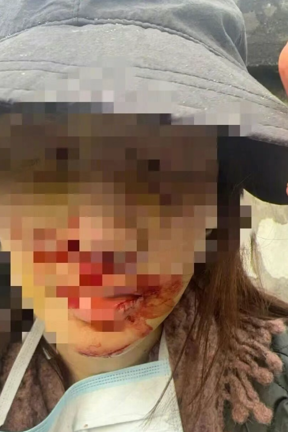 警方通报“金晨肇事逃逸”	，演员金晨发文致歉