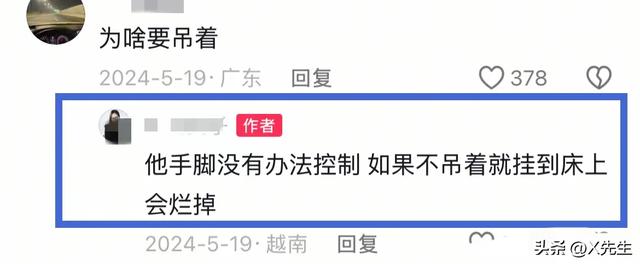 解脱了！越南“蝴蝶宝宝”去世，20多根绳子绑在床上，挂了50多年
