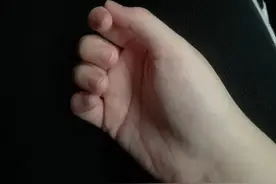 体检肿瘤标志物升高，是不是得癌症了？图片