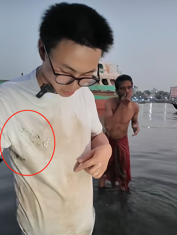 中国小伙在印度干了一杯恒河水，高烧三天全身肿胀，直言千万别喝