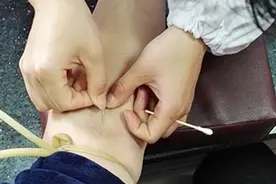 早期微量白蛋白尿可以逆转吗？医生：可以，但方法一定要对！图片