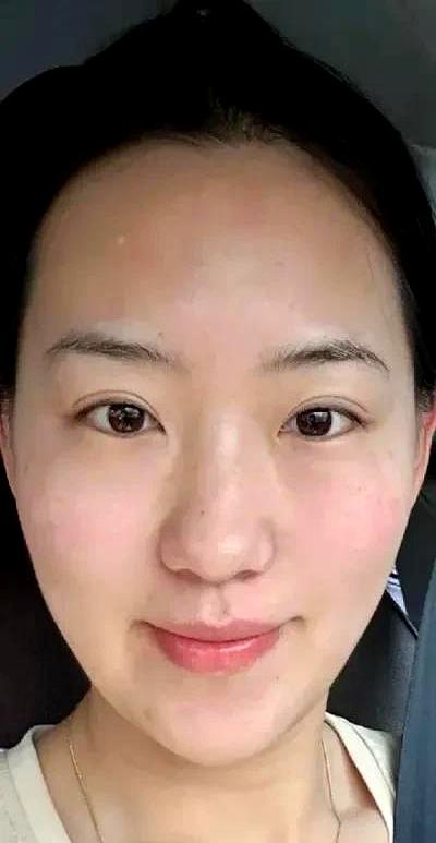 吹瓶子 67 天，法令纹淡到像开了美颜！急性子加个咬筷子，效果