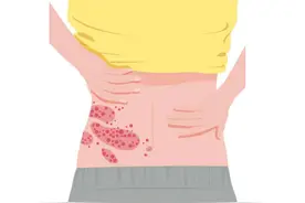 97%成年人携带带状疱疹，50岁以上人群发病率高，这些信号要当心图片