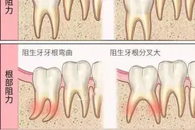 如何防范“不请自来”的骚扰电话？教你几招轻松屏蔽图片