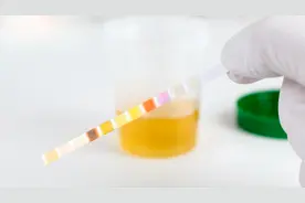晨尿泡沫多白天却无，是肾在向你求救?图片