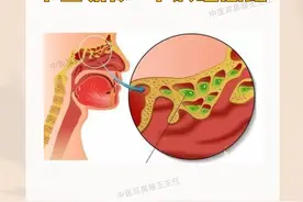鼻涕倒流：前面流不出往后倒流，中医教你1个正确调理思路！图片