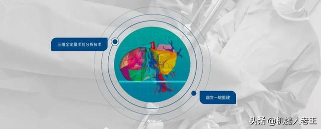 手术刀尖上的科技革命：盘点20家国内手术机器人领军企业