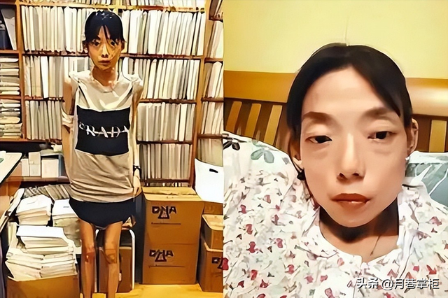 一代女神沦为豪门玩物？结婚8年牙齿全掉，器官切除，面似骷髅