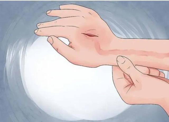【乐飞说甲状腺】你知道甲状腺囊肿是怎么造成的吗？会恶变吗？