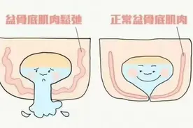 职场社死！深圳36岁女子确诊“尴尬病”！医生提醒：这类人要注意图片