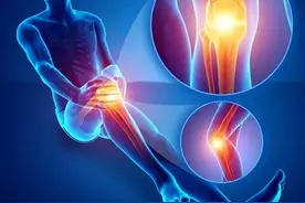 膝关节内侧疼 怎么办？图片