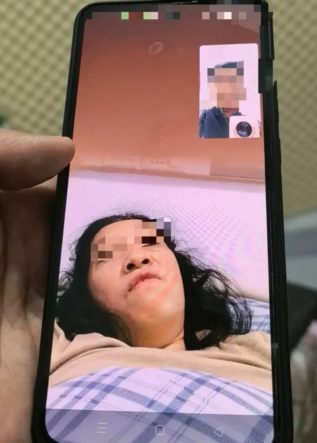 女子小区散步遭大狗咬断手筋	，小伙冲下2楼摁住肇事狗，手掌被咬穿，最新情况→