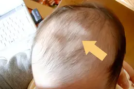 宝宝头小和智力有关吗？具备4个特征的孩子，健康又聪明图片