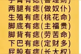 痣相知识，终于有人整理齐全了图片