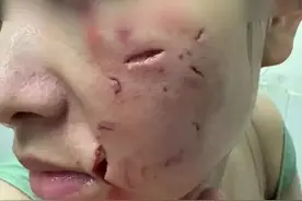 破相了吧！爱狗需有度，陌生狗不能随便抚摸图片
