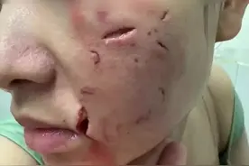 破相了吧！爱狗需有度，陌生狗不能随便抚摸图片