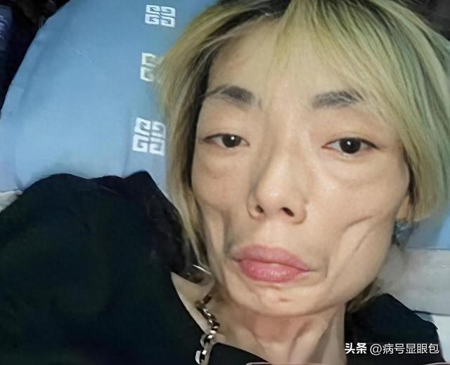 一代女神沦为豪门玩物？结婚8年牙齿全掉，器官切除，面似骷髅