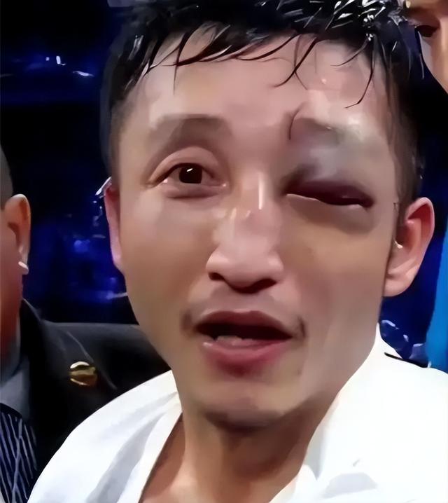 拳王邹市明自爆破产，不止赔光2亿	，其妻子参加婚礼耍酒疯