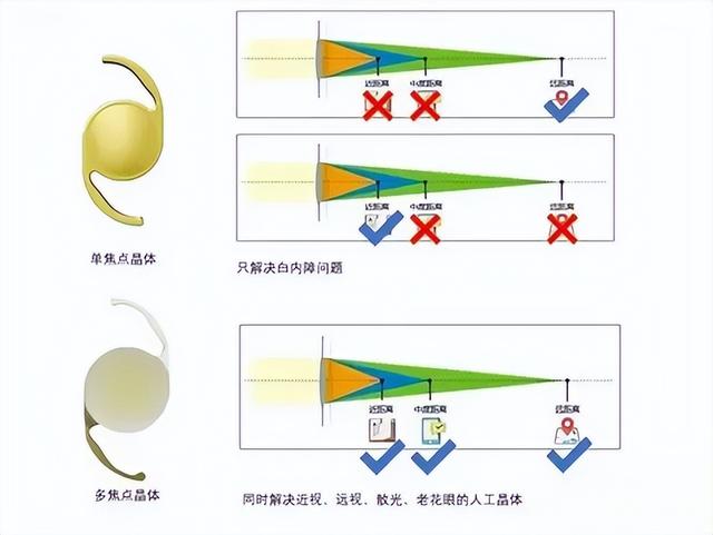 【眼科医院健康科普】老花眼不可怕，屈光手术有办法