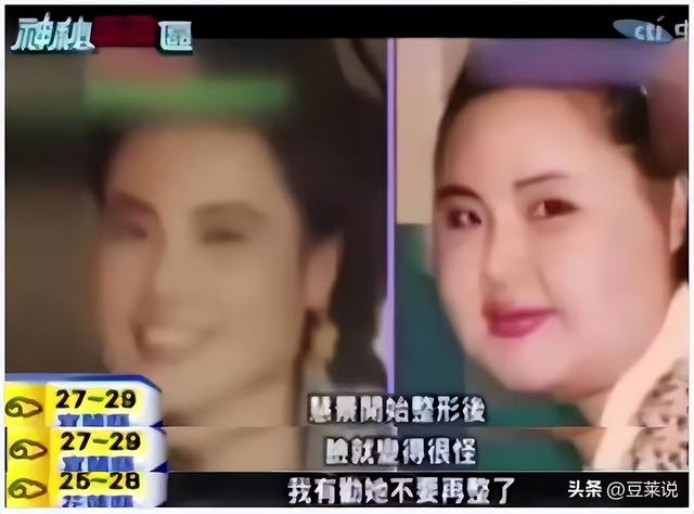 “整容上瘾”韩慧景：把脸整成电风扇，自行注射食用油，代价惨痛