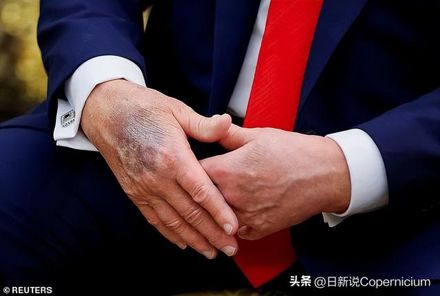 美斡旋后俄乌局势为何仍没出现好转