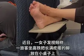 辣眼睛!高铁旅客将长满疙瘩的脚放桌板上!网友:恶心都溢出屏幕了图片