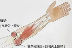 长治市第二人民医院：“能屈能伸”很重要 肘关节僵硬怎么办？图片
