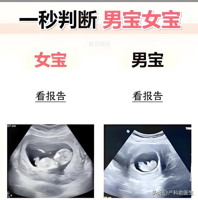 NT检查真能辨别胎儿性别？揭秘医学真相。