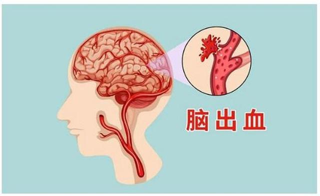 中秋节刚过，就有5位名人离世，车祸、肺癌、脑出血，最小仅31岁