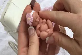 美国“拇指姑娘”：出生时仅25厘米，重280克，后来活下来了吗？图片