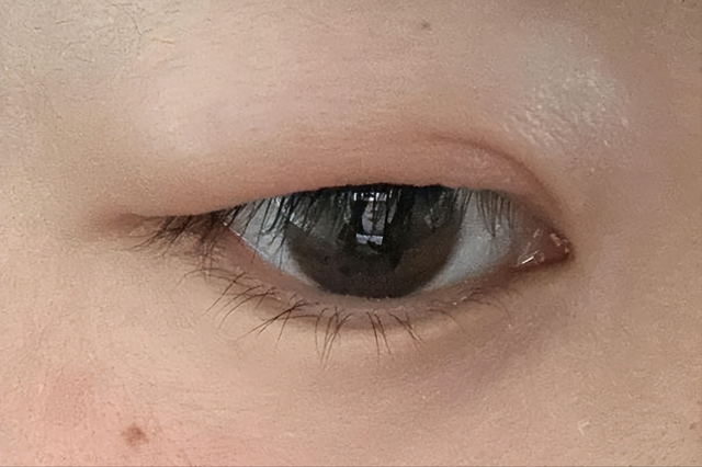 女人有没有妇科病，看脸就知道？脸上有几种表现，说明你要当心了