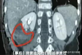 后续来了！被恶犬咬伤的成都女童仍未苏醒，邻居说狗主人不是女性图片