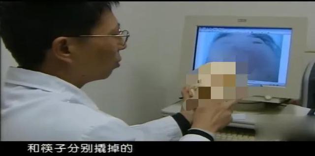 人狠起来究竟有多可怕？15岁女孩受虐5年，被利器撬掉所有牙齿！
