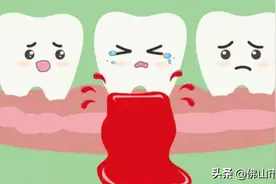 北大“韦神”牙齿缺失？警惕口腔中的“沉默杀手”——牙周炎！图片