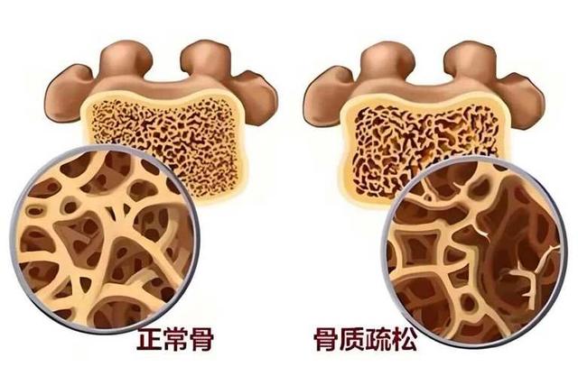 医生坦言：男性一旦彻底戒烟，用不了一年，身体会收获这6个改变