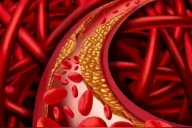 冬天最怕血管堵！分享4个厉害的中成药，给血管做个“大扫除”！图片