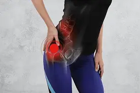 久坐屁股痛是坐骨神经痛？警惕：臀部不适，病根得找准。图片