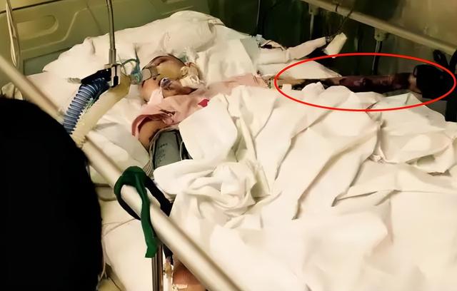 26岁就已离世！全身溃烂没钱医治而亡，被全家8口“吸血”多年
